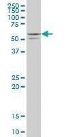 Anti-STK25 Antibody