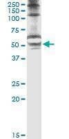 Anti-STK25 Antibody