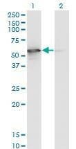 Anti-STK25 Antibody