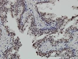 Anti-STK32C Antibody