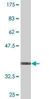 Anti-STK40 Antibody