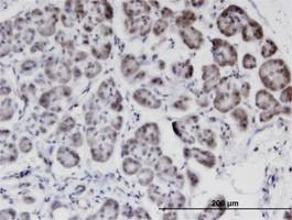 Anti-STK40 Antibody