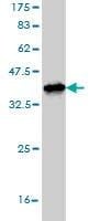 Anti-STMN2 Antibody
