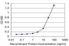 Anti-STYK1 Antibody