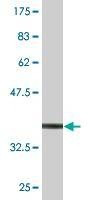 Anti-SUB1 Antibody
