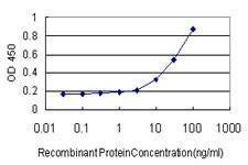 Anti-SUGT1 Antibody