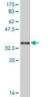 Anti-SULF1 Antibody