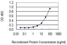 Anti-SULF2 Antibody