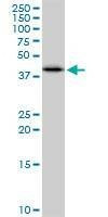 Anti-SULT2B1 Antibody
