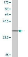 Anti-SUMO3 Antibody