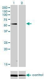 Anti-SUOX Antibody