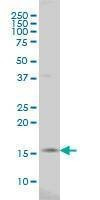 Anti-SURB7 Antibody
