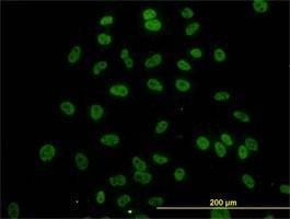 Anti-SURB7 Antibody