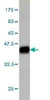 Anti-SURB7 Antibody