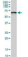 Anti-SWAP70 Antibody