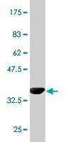 Anti-SWAP70 Antibody