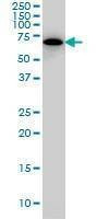 Anti-SWAP70 Antibody