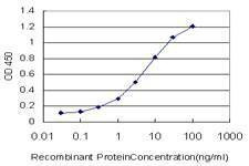 Anti-SWAP70 Antibody
