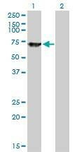 Anti-SWAP70 Antibody