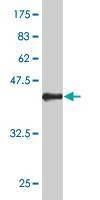 Anti-SYN1 Antibody