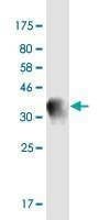 Anti-SYT13 Antibody