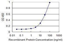 Anti-TAGLN Antibody