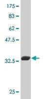Anti-TAL2 Antibody