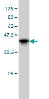 Anti-TAOK3 Antibody