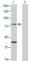 Anti-TAP1 Antibody