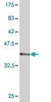 Anti-TBC1D8 Antibody
