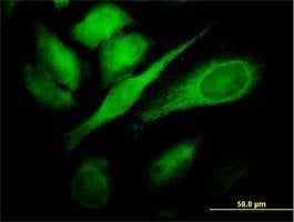 Anti-TBC1D8 Antibody
