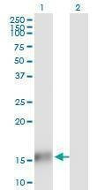 Anti-TBCA Antibody