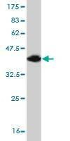 Anti-TBR1 Antibody