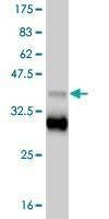 Anti-TBX18 Antibody