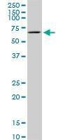 Anti-TBX18 Antibody
