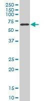 Anti-TBX18 Antibody