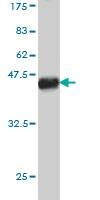 Anti-TBX5 Antibody