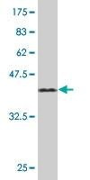 Anti-TCAP Antibody