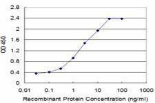 Anti-TCAP Antibody