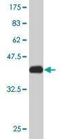 Anti-TCEB2 Antibody