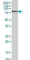 Anti-TCF12 Antibody