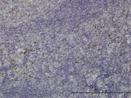 Anti-TCF12 Antibody