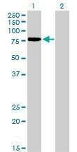 Anti-TCF12 Antibody