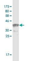 Anti-TCF3 Antibody