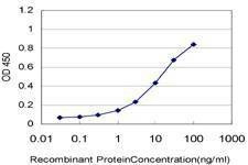 Anti-TCL1A Antibody