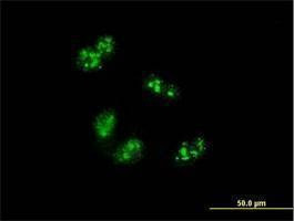 Anti-TCOF1 Antibody