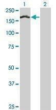 Anti-TCOF1 Antibody