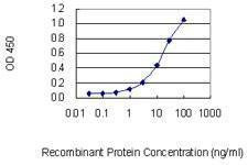 Anti-TCOF1 Antibody