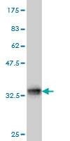 Anti-TCOF1 Antibody