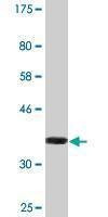 Anti-TECTA Antibody
